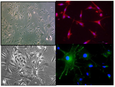 Bright & Immunofluorescence image of Melanocytes cells