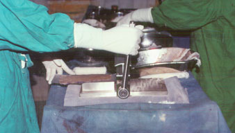 Skin Graft Meshes can expand skin 1.5 times, 3 times or 6 times the original size